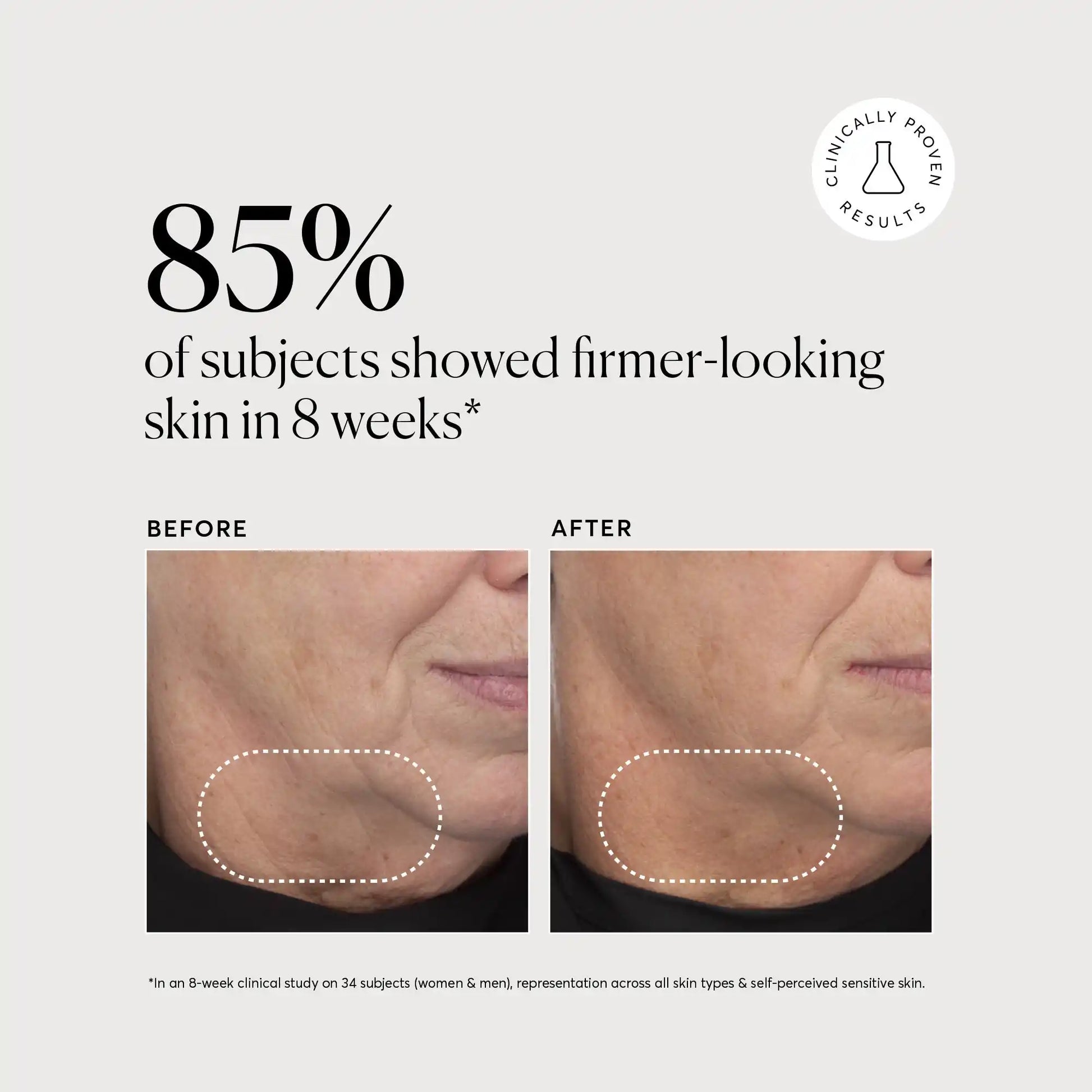 retinol-complex-serum-l8 NATR-10034-Alt-Images-Retinol-Complex-Serum-04.webp
